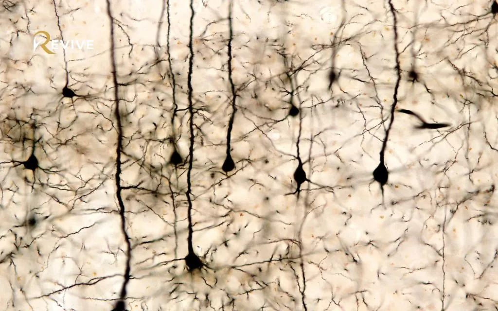 TMS for Bipolar Depression: Understanding Bipolar Depression and Treatment Options